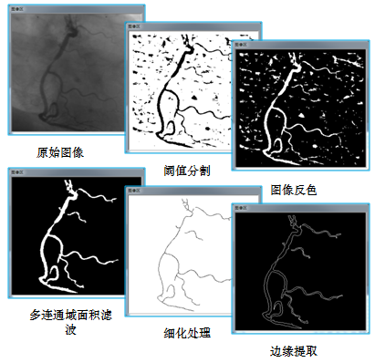 机器视觉-应用实例